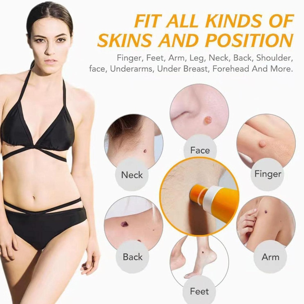 Auto Skin Tag Removal Kit For  - огляд і ціна Skincare Ingredients Checker