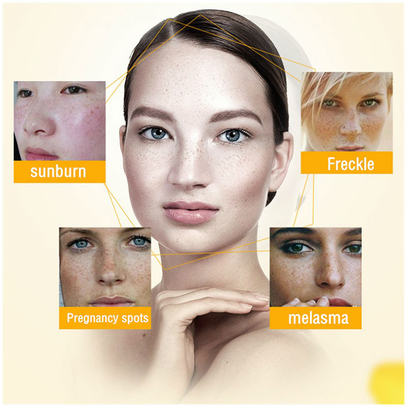 Dimollaure Whitening Freckle C - огляд і ціна Skincare Retinol