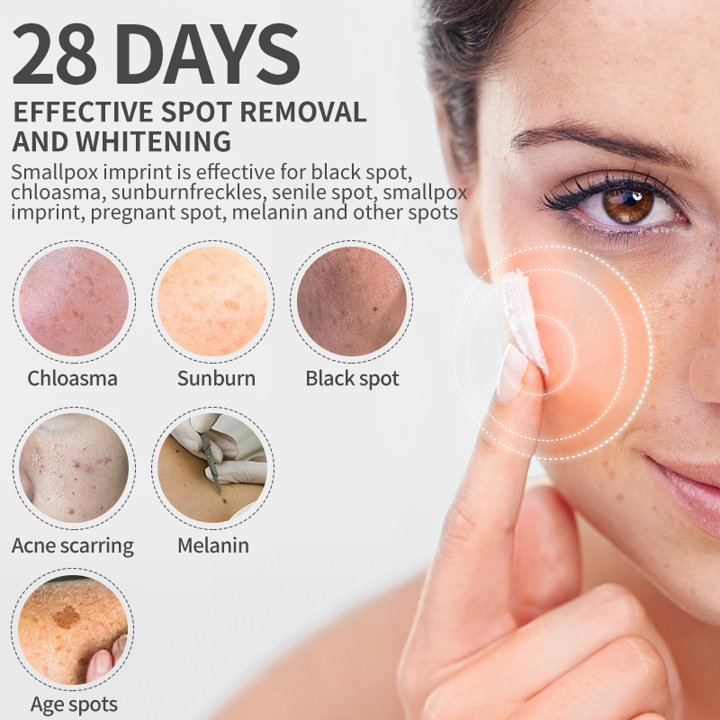 Dimollaure Whitening Freckle C - огляд і ціна Skincare Retinol